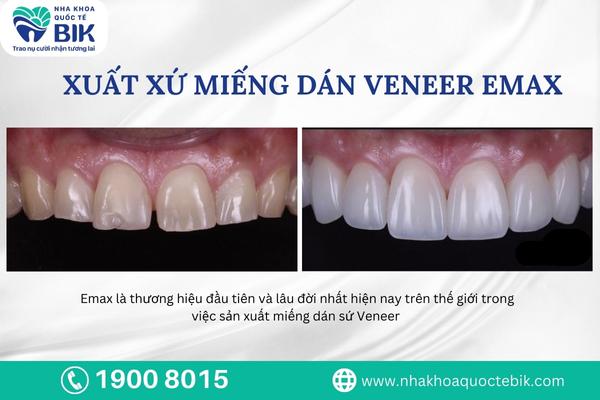 xuat-xu-mieng-dan-veneer-emax