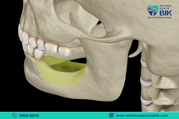 jawbones are not strong enough, so choose removable dentures