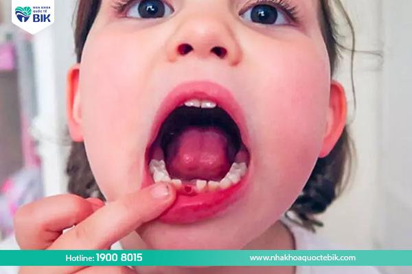 Factors affecting the process of replacing baby teeth