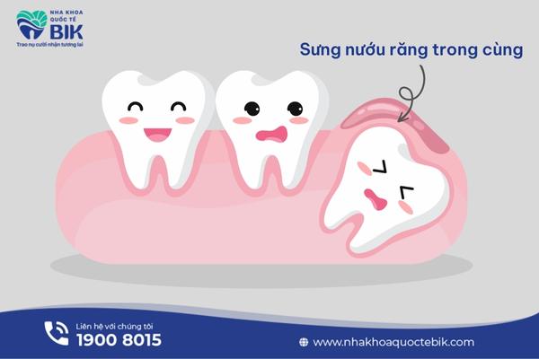 Swollen gums in the innermost tooth