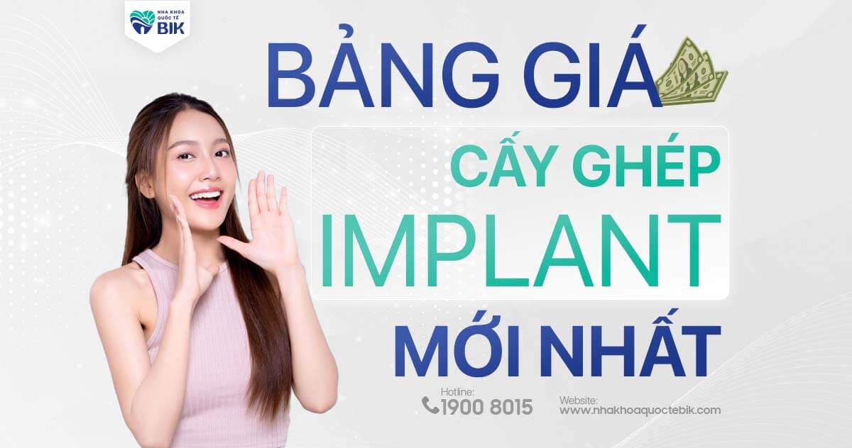 ​Bảng giá cấy ghép Implant mới nhất