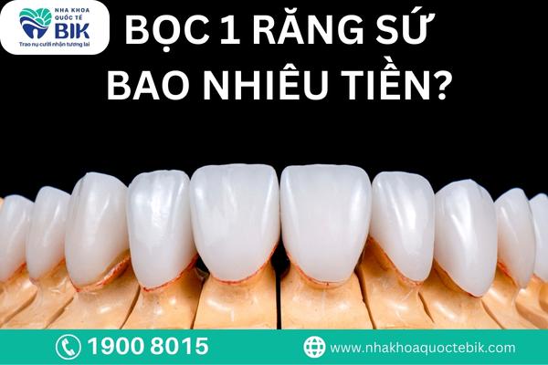 Bọc răng sứ giá bao nhiêu?