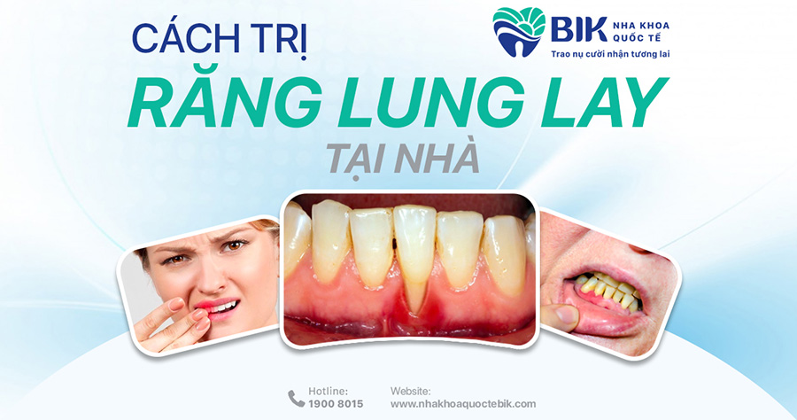 Một Số Cách Trị Răng Lung Lay Hiệu Quả Ngay Tại Nhà