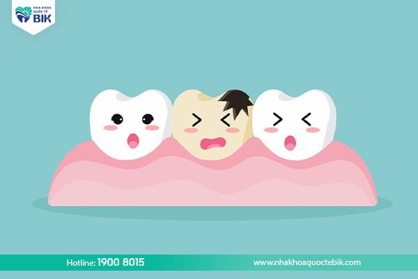 Causes of permanent tooth decay