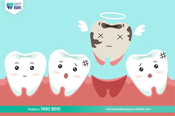 Consequences if permanent tooth decay is not treated