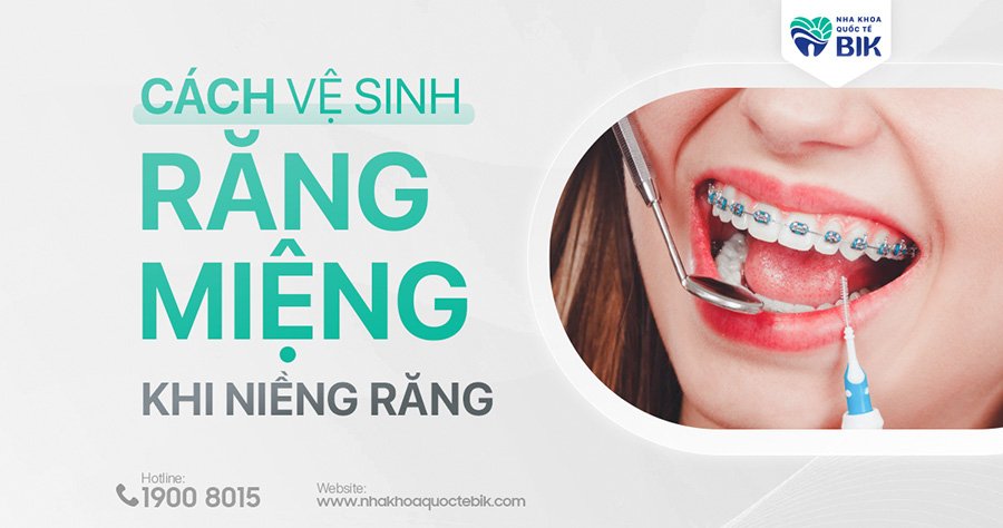 Cách Vệ Sinh Răng Miệng Khi Niềng Răng Hiệu Quả