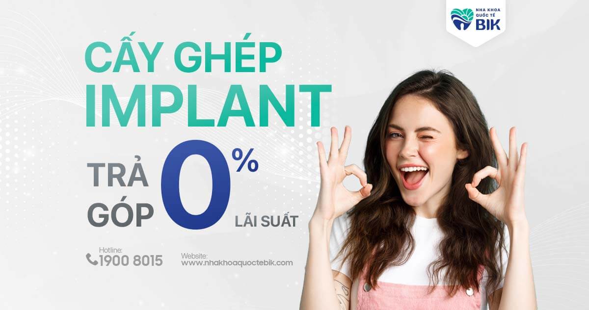 Cấy ghép implant trả góp 0% lãi suất