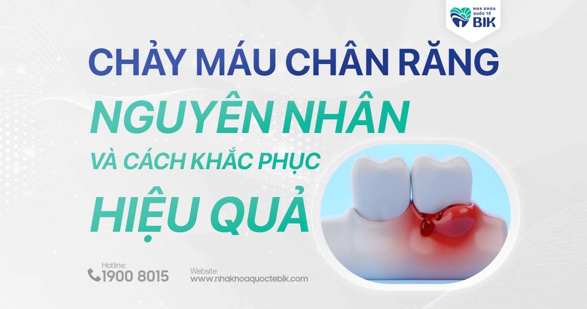 Chảy máu chân răng: Nguyên nhân và cách khắc phục hiệu quả