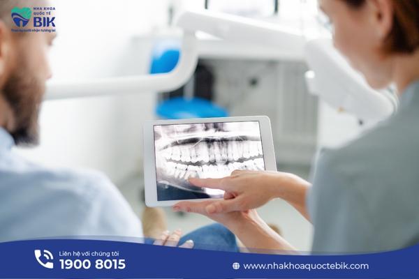 When is it necessary to take a dental X-ray?