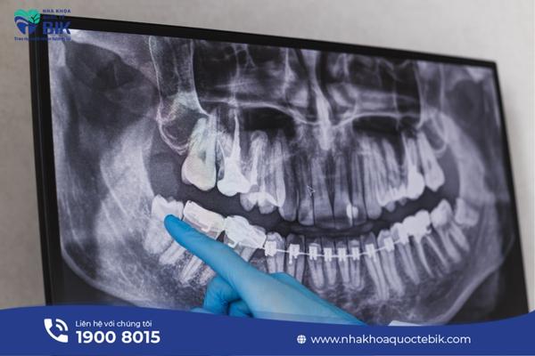 What are the dental X-ray techniques?