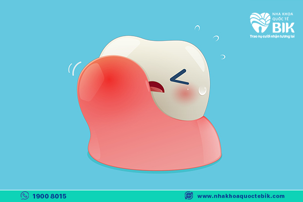 Is wisdom tooth extraction dangerous and complications that can occur