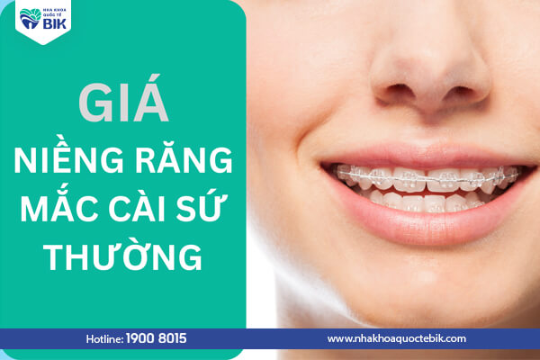 Price of conventional (traditional) ceramic braces