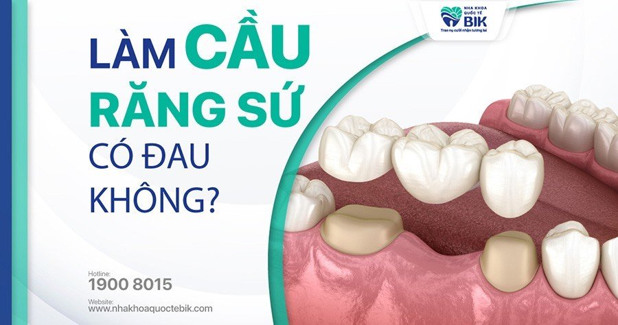 Làm Cầu Răng Sứ Có Đau Không? Bị Đau Do Đâu?