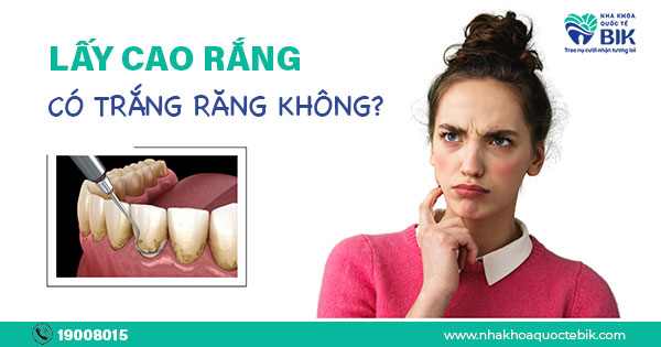 Lấy Cao Răng Tại Nha Khoa Có Làm Trắng Răng Không?