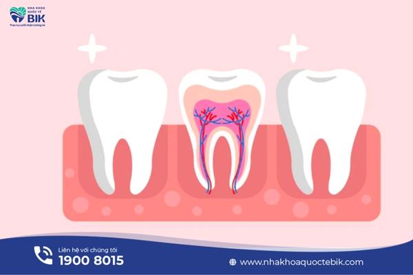 When should root canal treatment be performed?