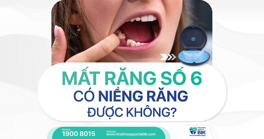 MấtRăngSốCóNiềngRăngĐượcKhông?