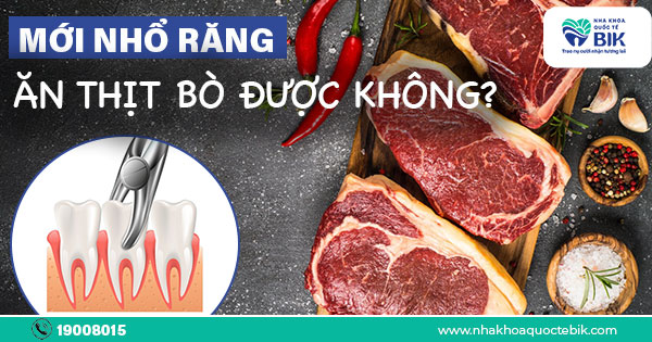 Mới Nhổ Răng Ăn Thịt Bò Được Không?