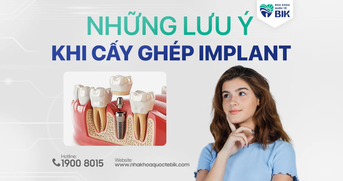 Những lưu ý khi cấy ghép implant