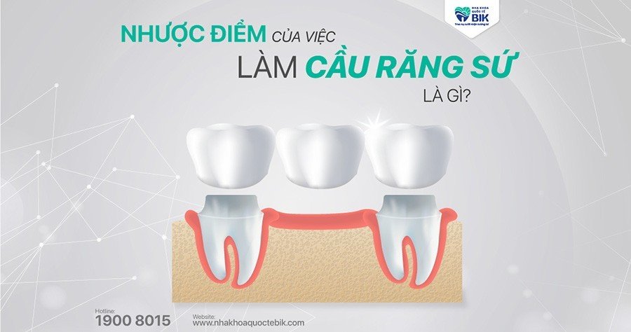 Nhược Điểm Của Làm Cầu Răng Sứ Là Gì?