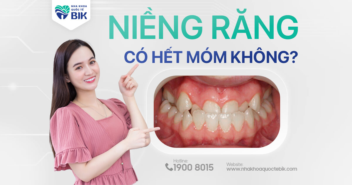 Niềng răng có hết móm không