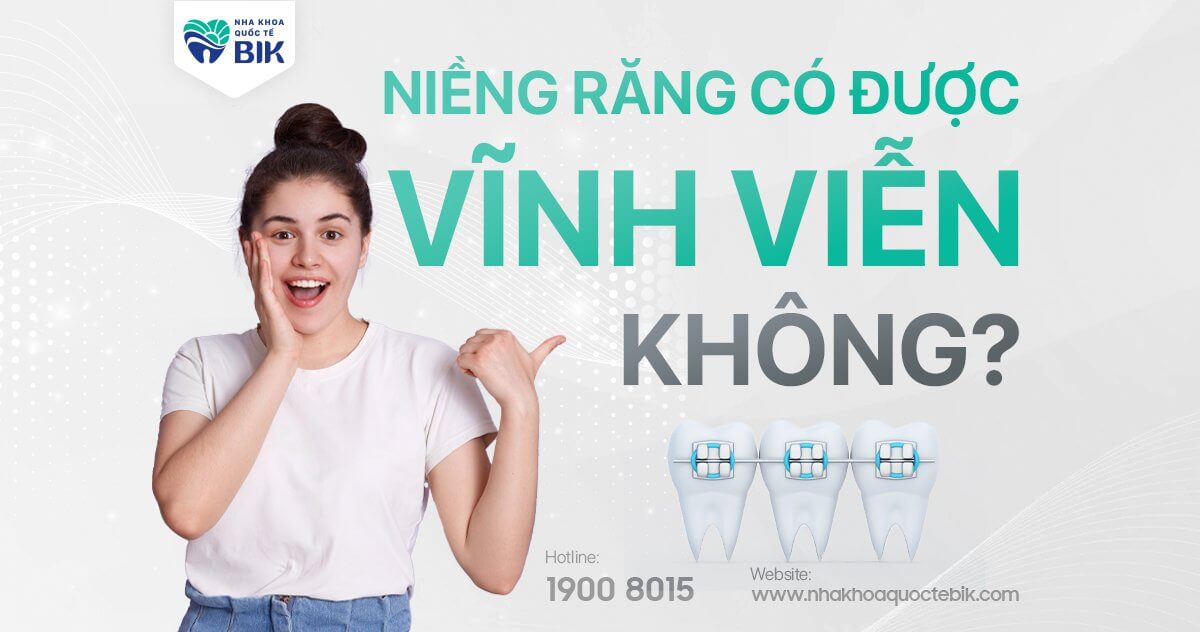 Niềng răng có vĩnh viễn được không