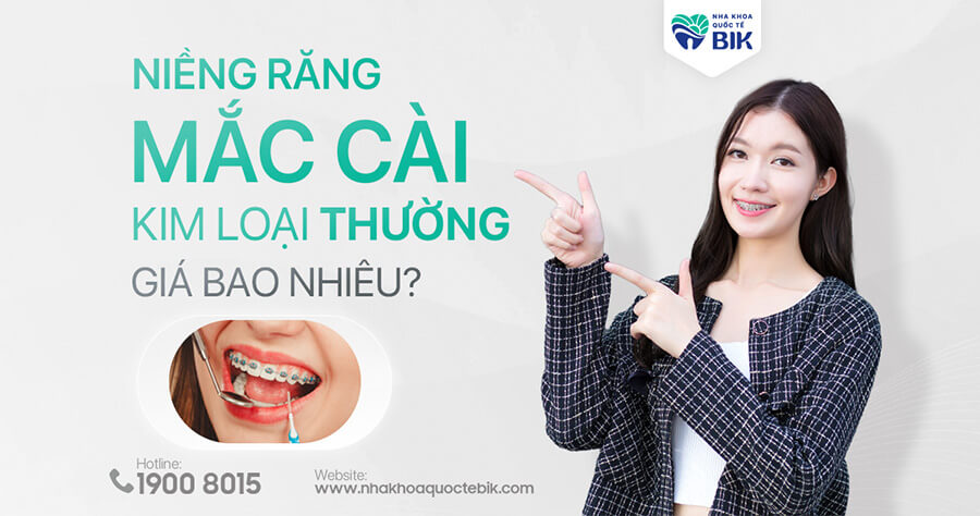 Niềng Răng Mắc Cài Kim Loại Thường