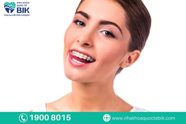 Advantages of clear braces