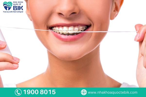 High orthodontic efficiency