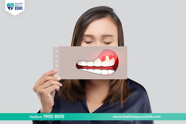 Loose teeth due to periodontal disease