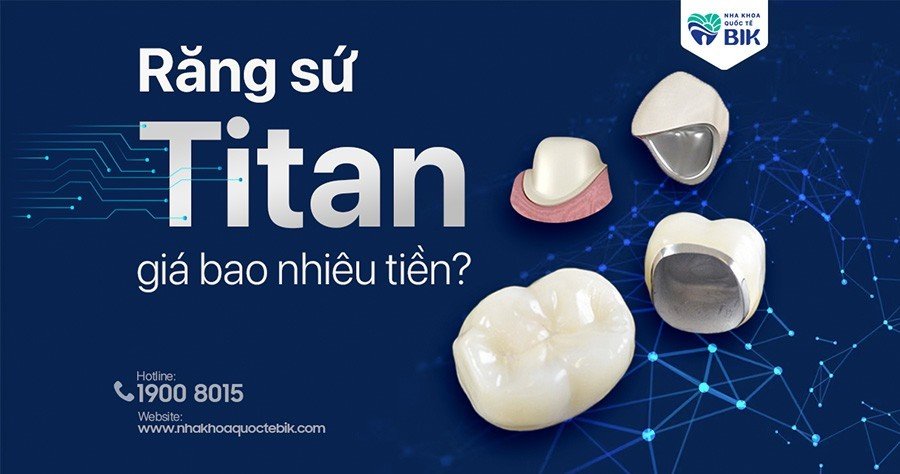 Bọc Răng Sứ Titan Giá Bao Nhiêu Tiền? Có Tốt Không?