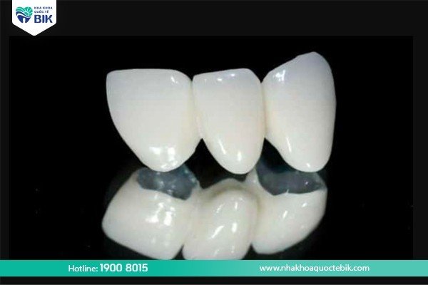 Are Titan porcelain teeth good?