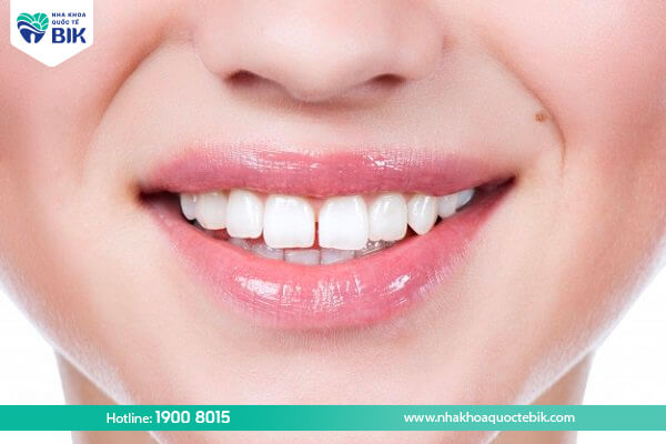 What are the effects of gapped teeth?