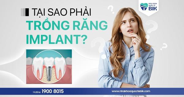 Tại Sao Phải Trồng Răng Implant? Gắn Implant Có Đau Không?