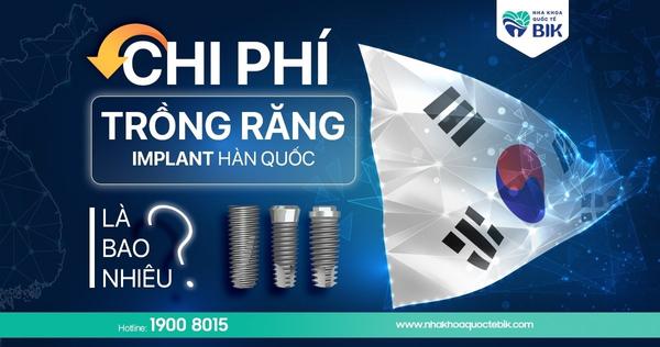 Trồng răng implant Hàn Quốc và những điều bạn nên biết