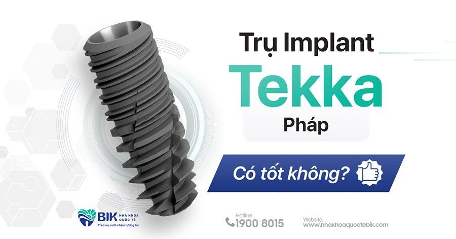 Trụ Implant Tekka Pháp Có Tốt Không? Giá Bao Nhiêu?