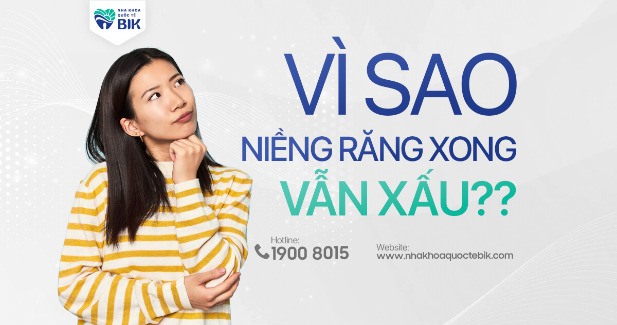 Vì sao niềng răng xong vẫn xấu